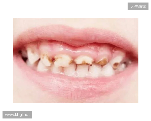 韦林顿确诊上唇部贯通伤；11、21牙半脱位；上颌前牙区牙槽骨骨折